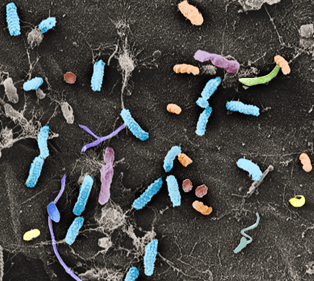 Scanning electron microscopy image of diverse bacteria on the surface of Arabidopsis thaliana roots. 